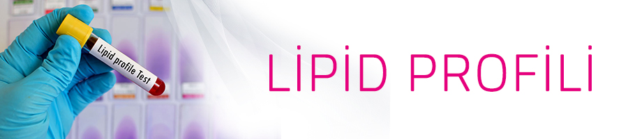 lipid profili